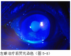 ZY016_21_5.gif
